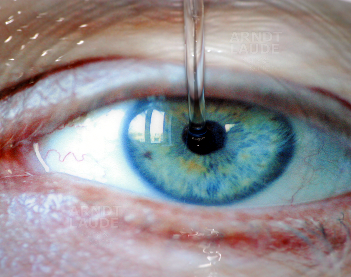 20100218_TheEye.png